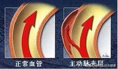 不想去医院第二弹！胸部不适的自我诊察