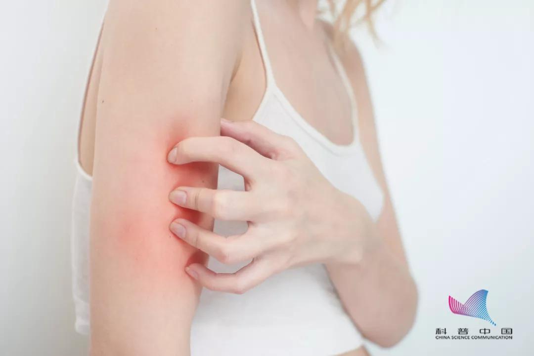 身上突然有很多小红点一会又消失,身上突然出现小红点用什么药