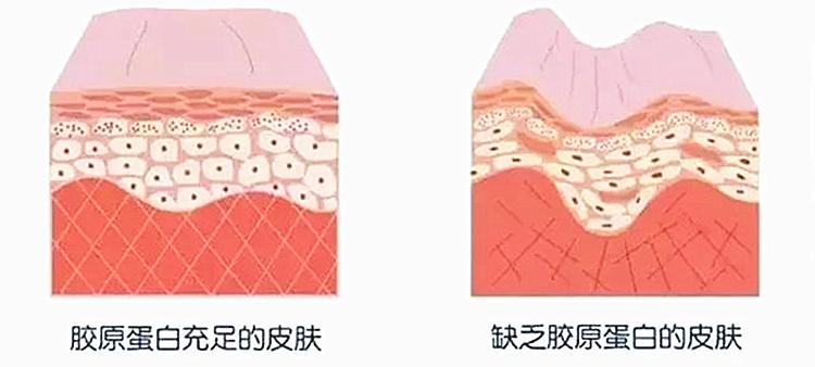 脸胖毁所有？3招教你解锁瘦脸指南