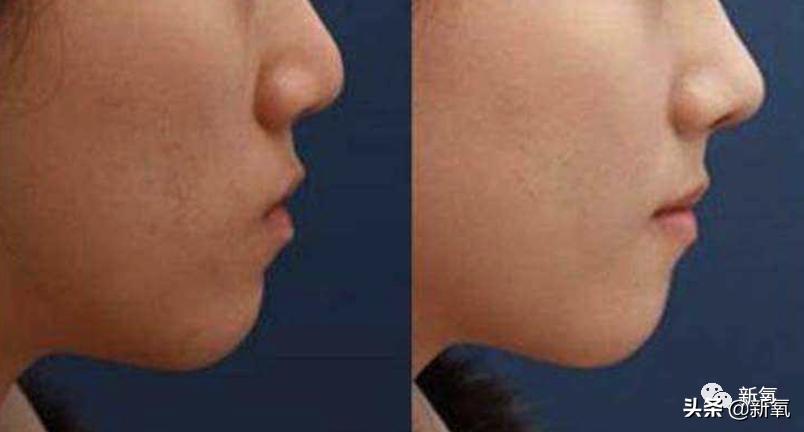 杨超越还能撑多久,杨超越遇到的真实事件