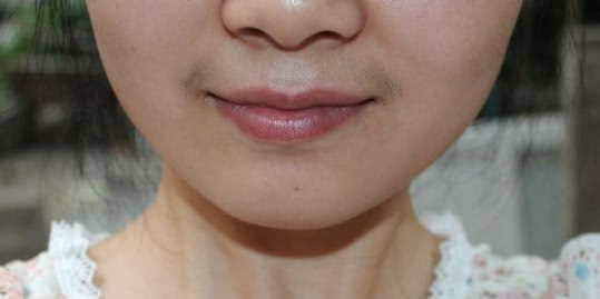 怎样去除唇毛没有副作用,唇毛怎么通过饮食去除
