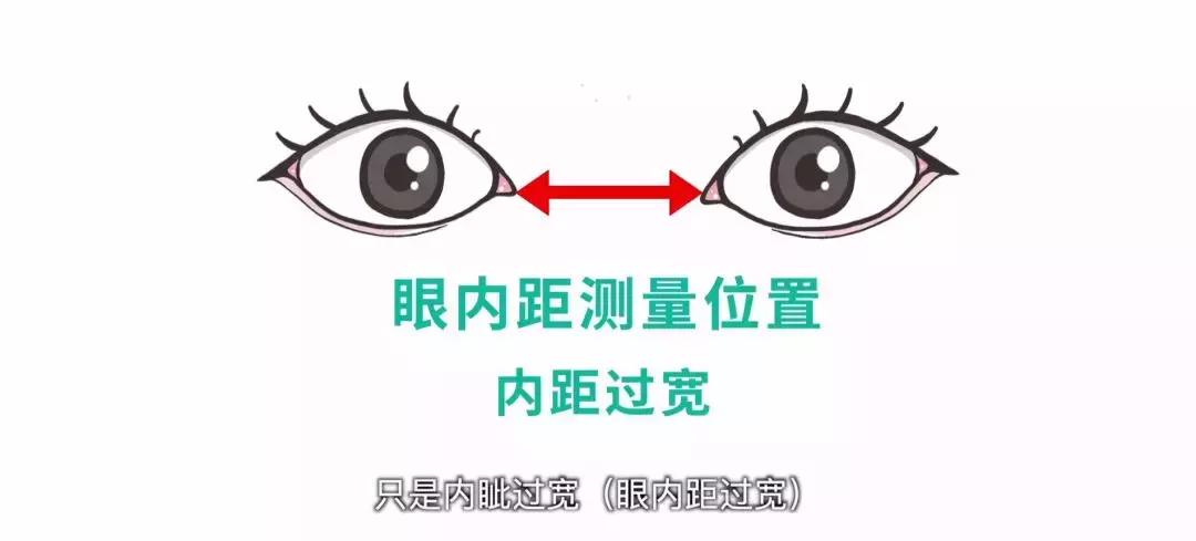 教你一招辨别宝宝真假斗鸡眼,怎么辨别自己眼睛不是斗鸡眼