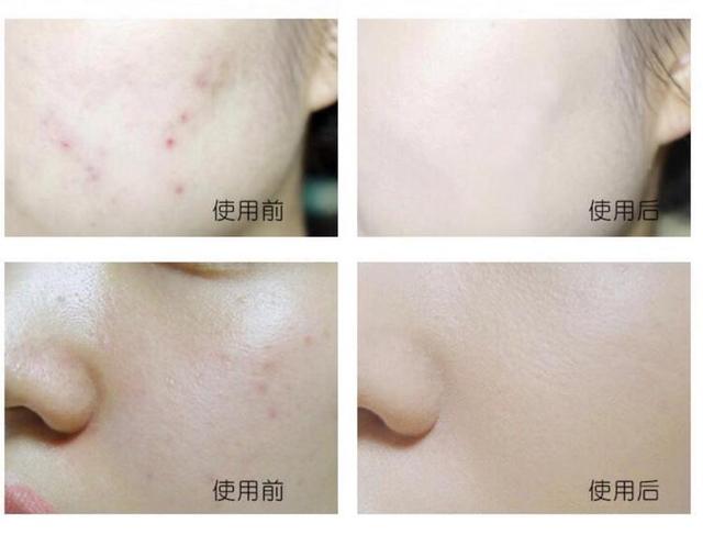 忆可恩防晒粉饼测评,韩国忆可恩粉饼怎么选色号