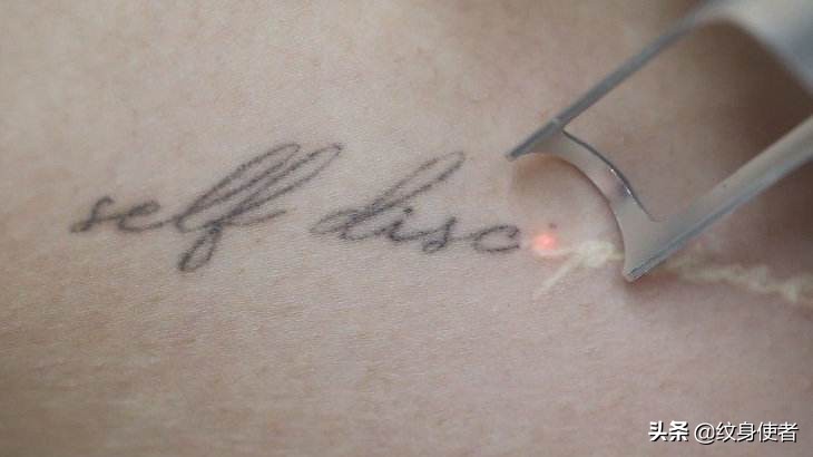 纹身说-第61期：纹身，洗得掉吗？