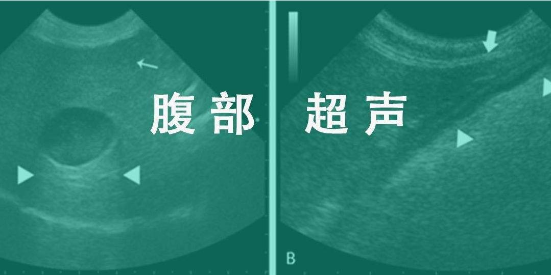 你以为妇产科的超声检查都是一样的吗？其实大有区别哦
