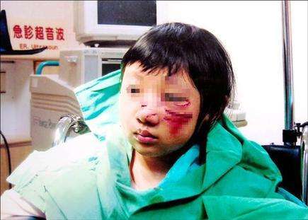 小孩遇到恶犬怎么办,遇到恶狗小孩怎么反击