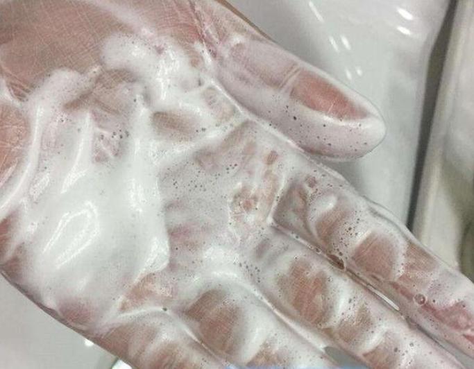 下巴凸起的颗粒怎么去除,下巴凸起小颗粒怎么消除