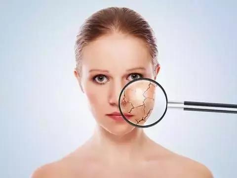 糖友易出现又纠结的8种皮肤病变，医生来支招