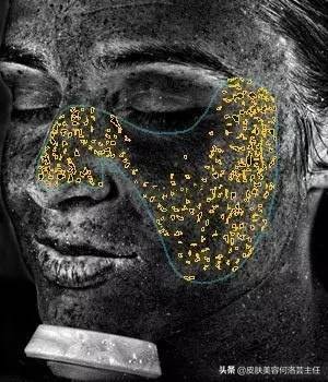 visia皮肤检测仪,visia皮肤检测报告数值越大越好吗