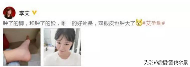 媳妇怀孕腿肿怎么回事,怀孕腿肿脚肿是什么原因引起的