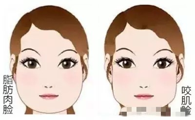 面部吸脂的真相,面部吸脂和双身体吸脂区别