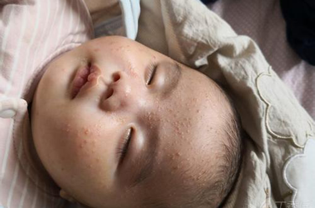 孕期吃鹅蛋真的去胎毒了吗？可能会让你长胖，但去不了“胎毒”