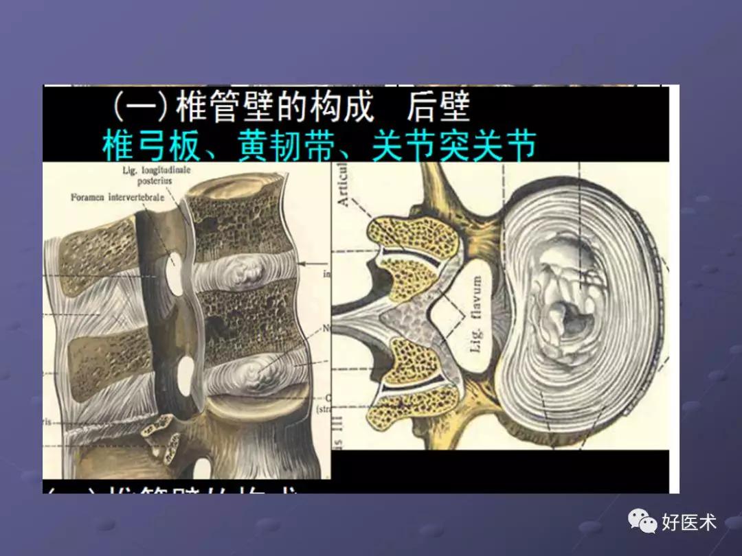 脊柱mri有哪些特点,乳腺疾病的mri诊断及鉴别