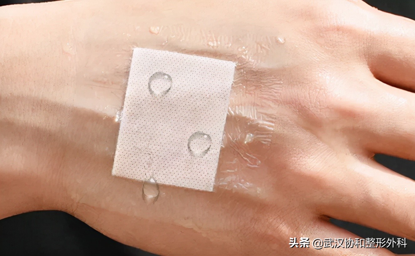 手术后怎么预防疤痕用什么药膏,预防疤痕增生最佳方法