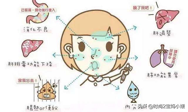 长痘痘不要怕祛痘有良方,长痘痘了该如何消痘不用任何药品