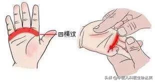 孩子积食怎么分辨寒还是热,小儿百病积食为先图片