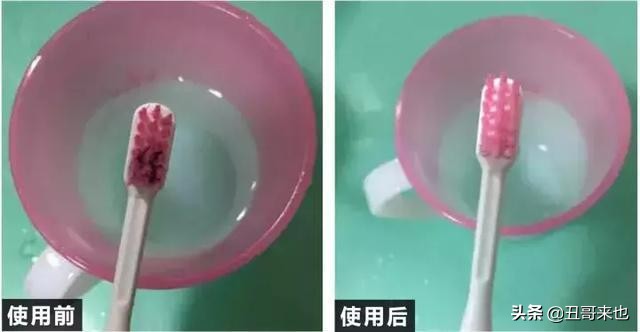 白衣服发黄在家就能处理,衣物变黄如何洗白妙招