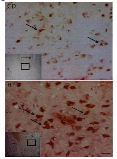 减肥期间管不住嘴要怎么去减肥,减肥管不住嘴馋怎么办