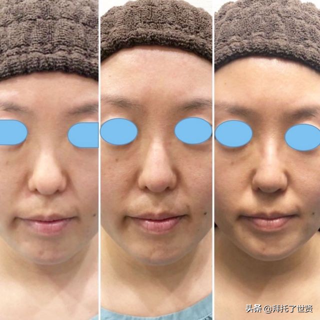 鏁村鍖荤敓璇勪环鐭冲師閲岀編,鐭冲師閲岀編鏁村舰鍖荤敓