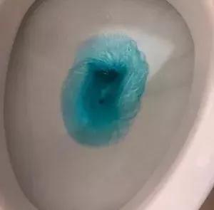 马桶黄污渍怎么去除妙招,马桶污垢发黄怎么去除