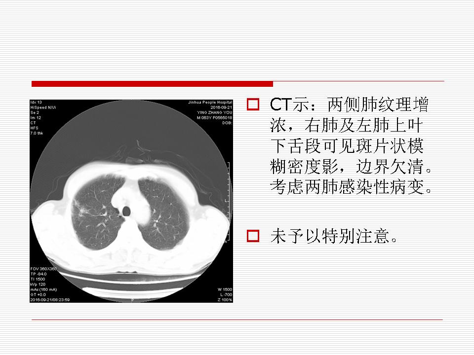 像炎症的肺癌能治好吗,医生说可能是肺癌也可能是炎症