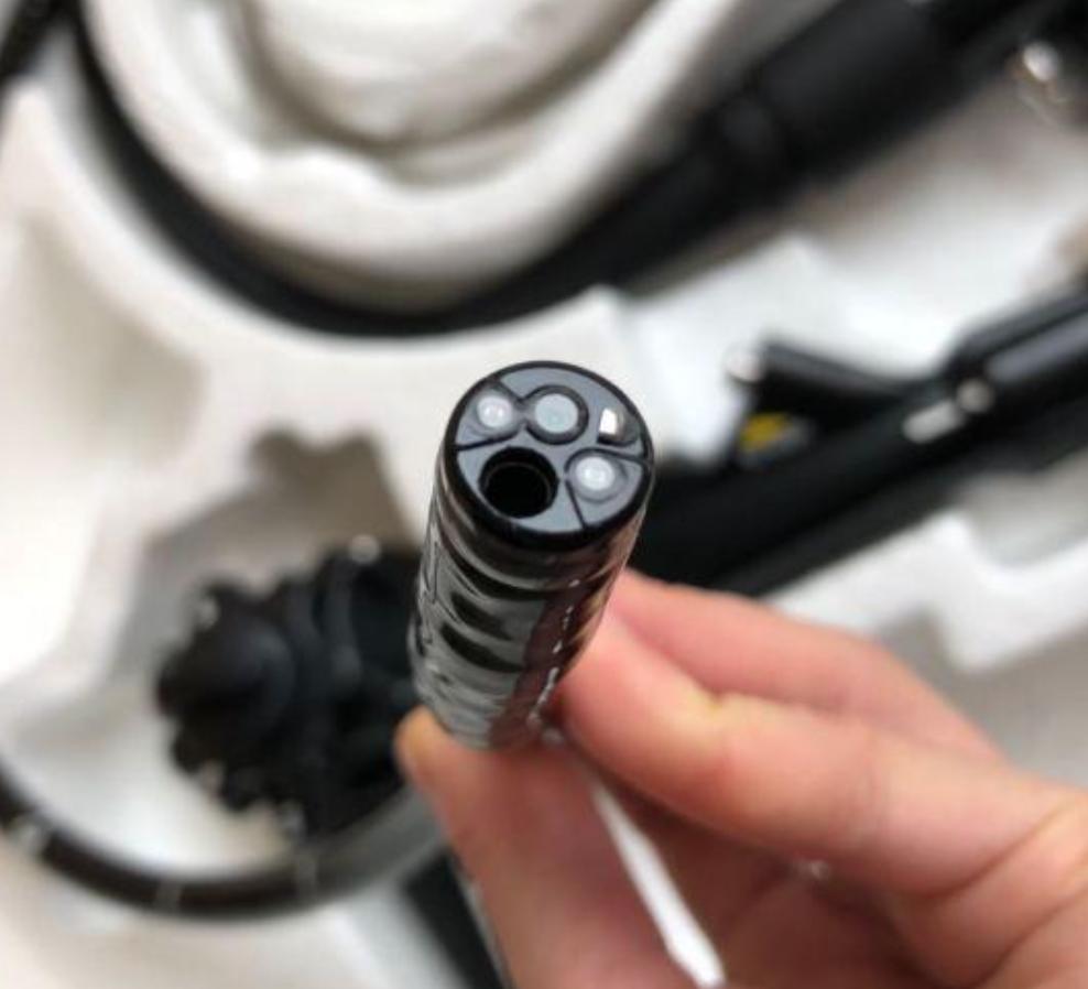 胃镜检查到底有多痛苦-消化内镜科普系列之一