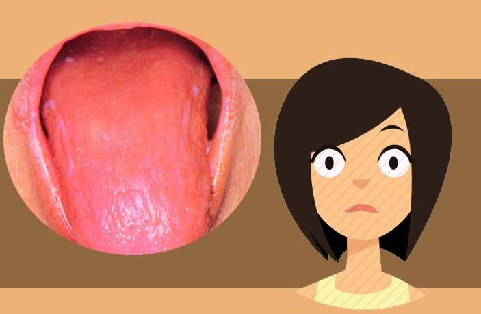 关于舌苔知道身体健康的视频,舌苔是健康的晴雨表吗