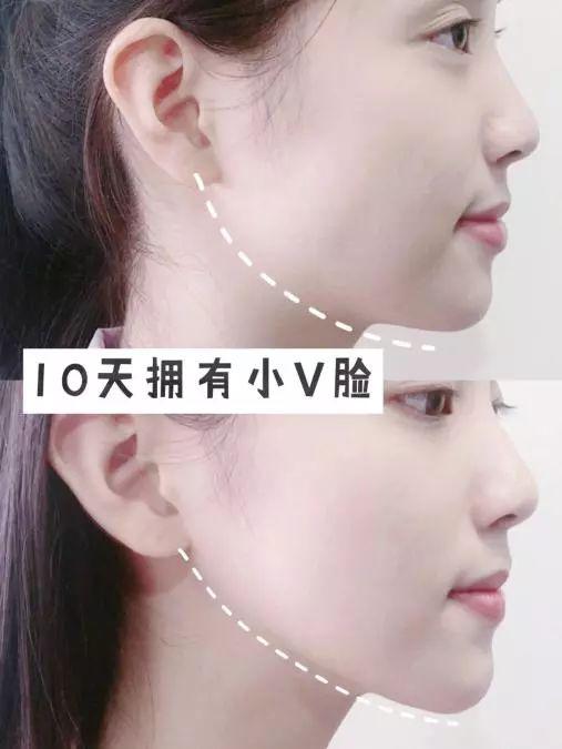 宋祖儿和王炸贴面膜,屈臣氏王炸产品