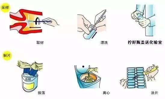 试管前的生化检查是指什么,做试管月经期要做几次检查