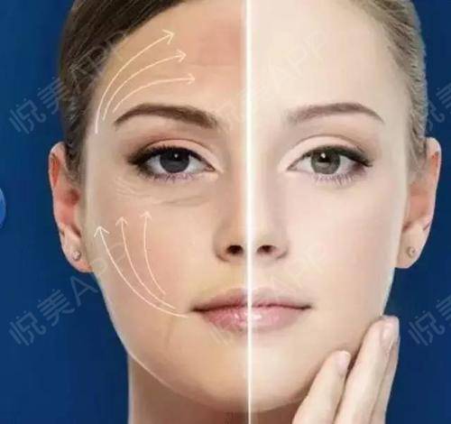 人衰老面部变化,面部衰老改善最好的方法