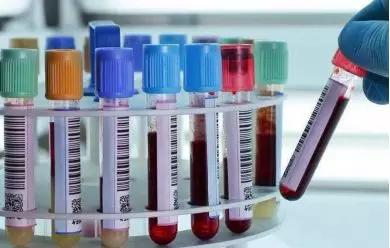 怎么排查糖尿病,女人爱作怎么处理