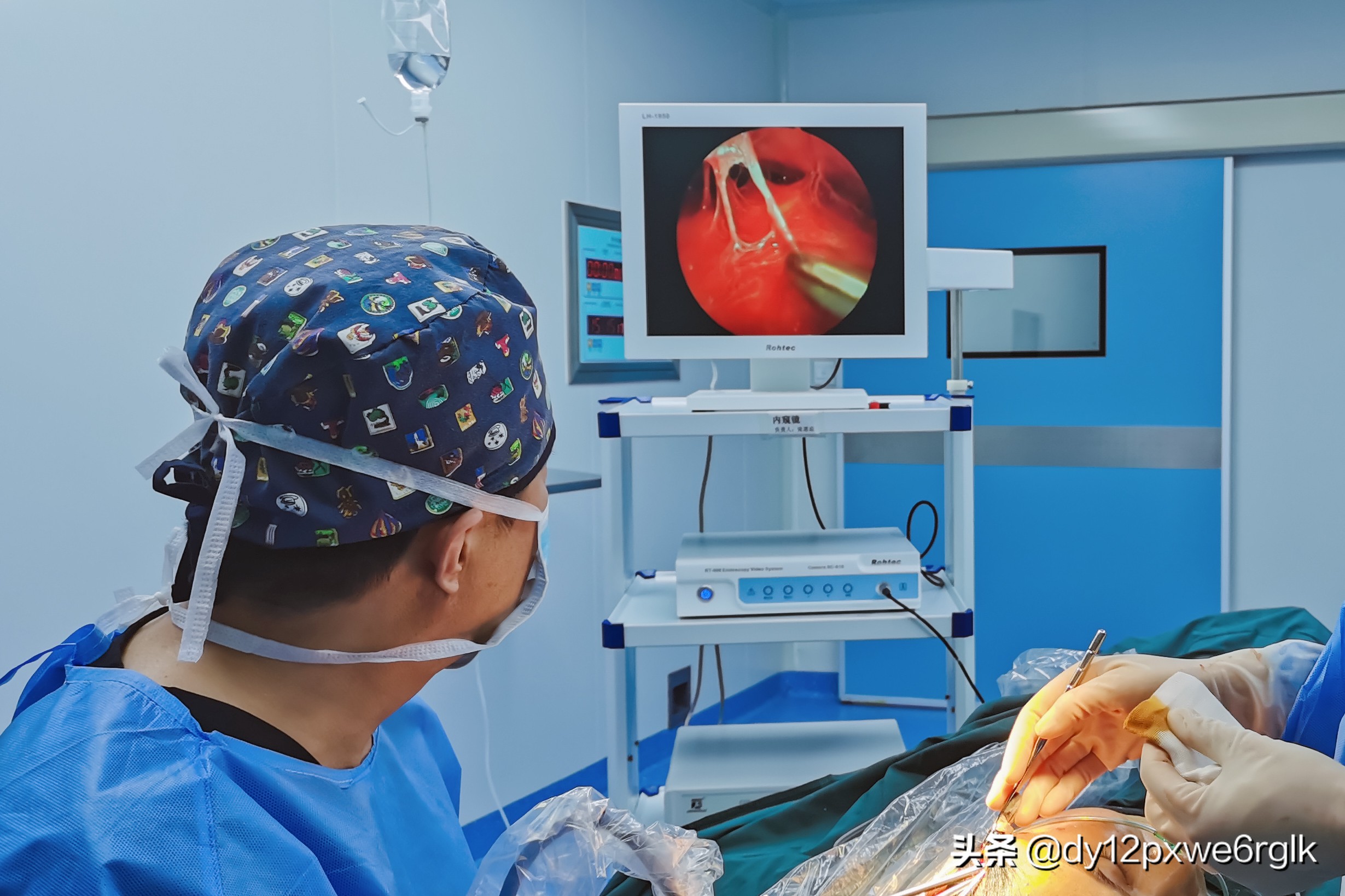 拉皮除皱明显的优点,拉皮除皱手术真的有效吗