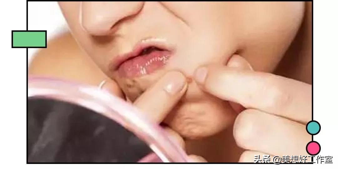 怎么祛痘印最有效简单方法,如何快速祛痘印最有效的方法