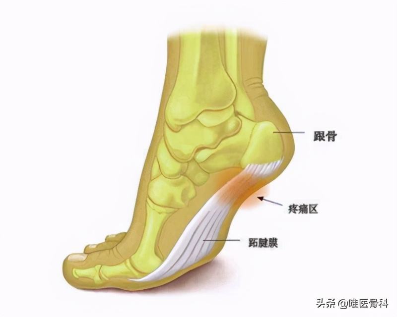 40-60岁脚后跟疼吃什么药,40-60岁脚后跟疼有啥办法