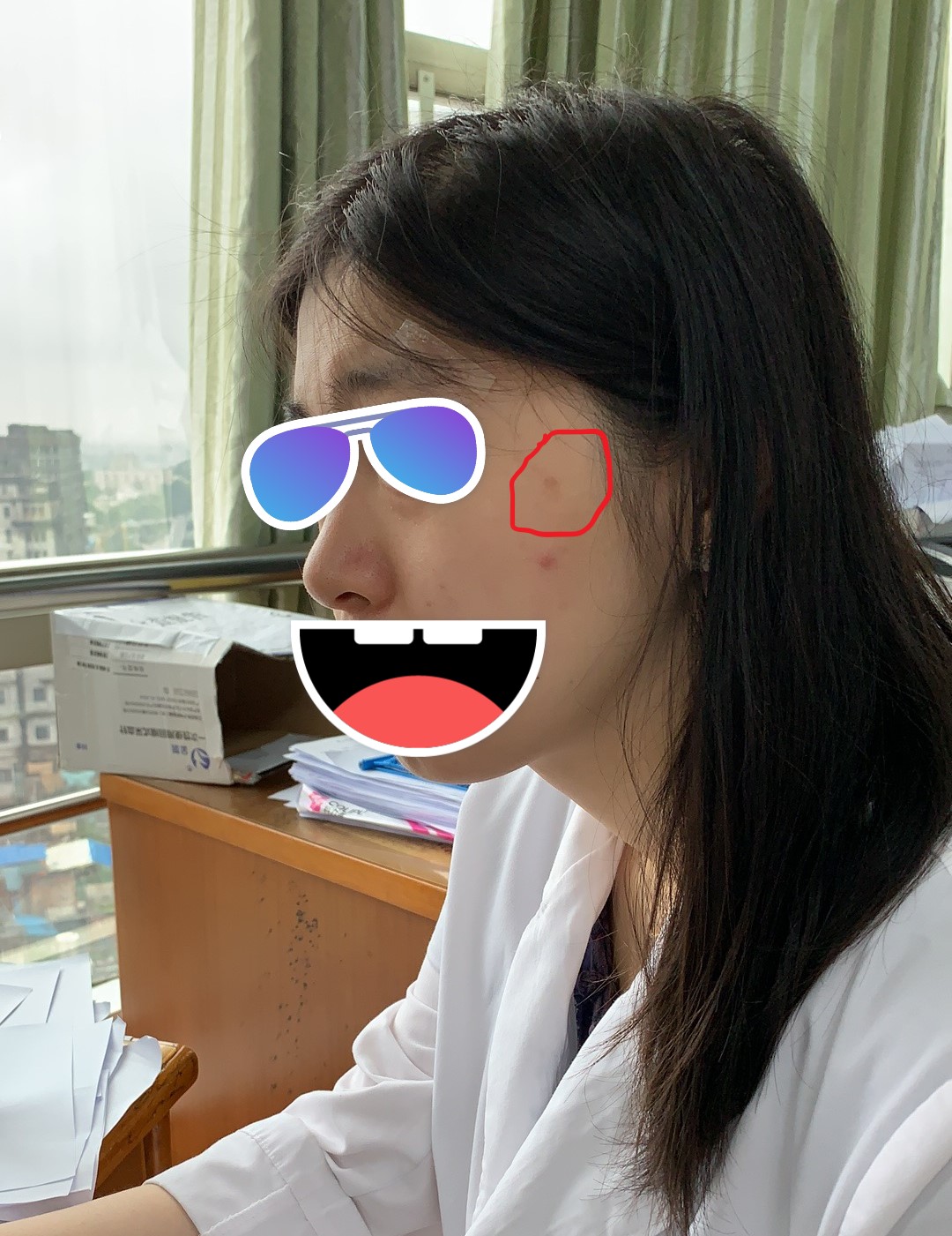 五天根治雀斑老年斑,有效的去除雀斑和老年斑的方法