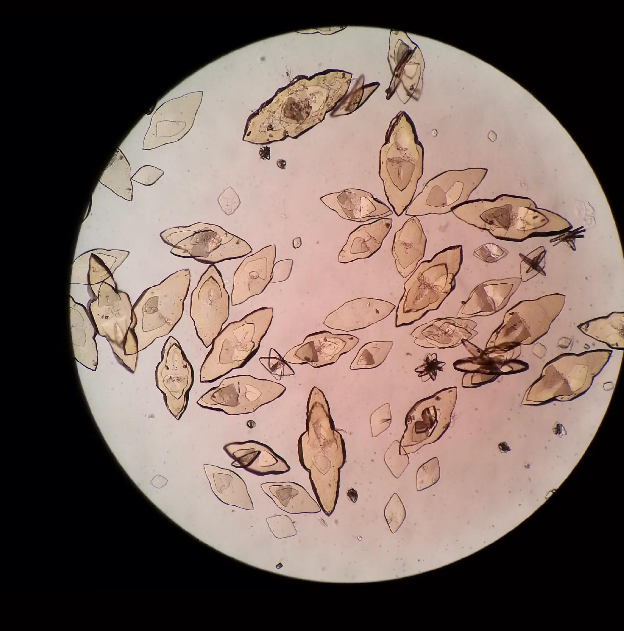 看尿酸化验单,检查尿酸600以上的图片