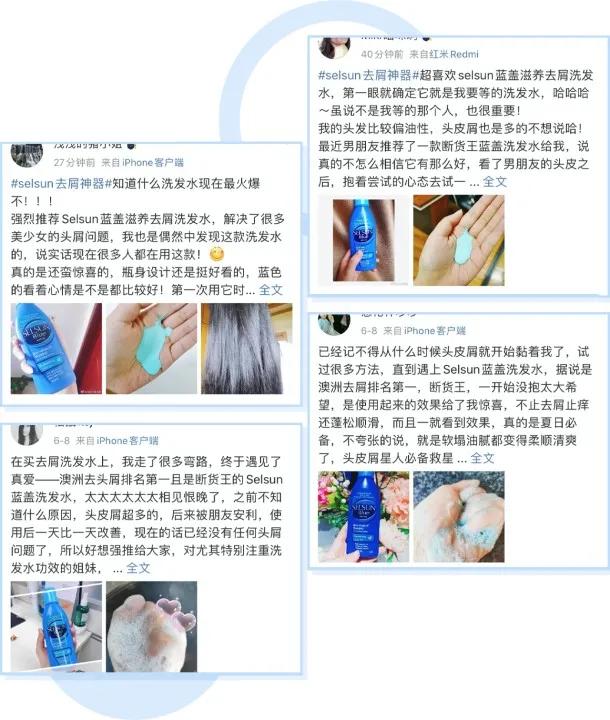 鞠婧祎全身造假,鞠婧祎头皮都整了吗