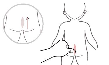 孩子腹泻食疗最简单方法,小儿推拿专家陈红主任腹泻手法