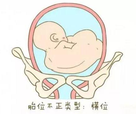 孕晚期胎心在肚脐右边胎位正吗,胎心与肚脐平行是什么胎位