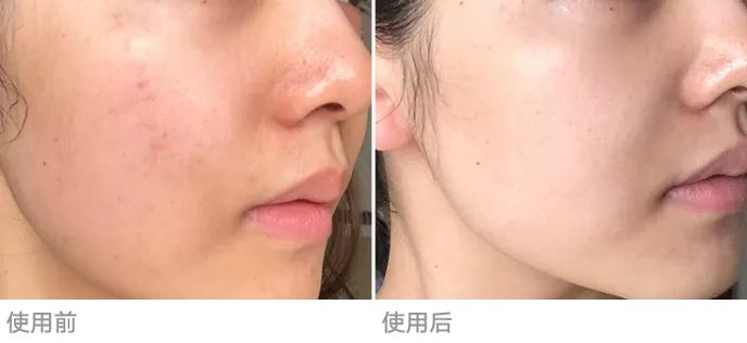 女人老去真的有那么可怕吗,女人应该怎样自然老去