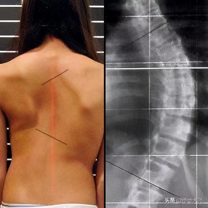 疼痛治疗学课程,疼痛康复培训班