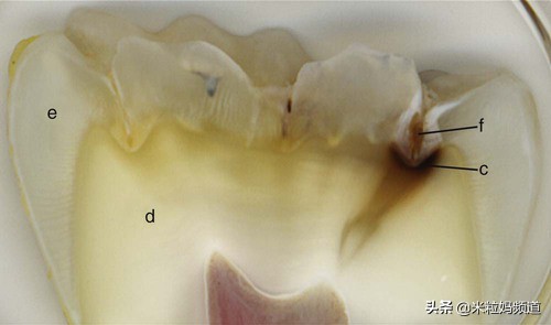 小朋友的蛀牙是怎么形成的,10岁小孩有7颗蛀牙