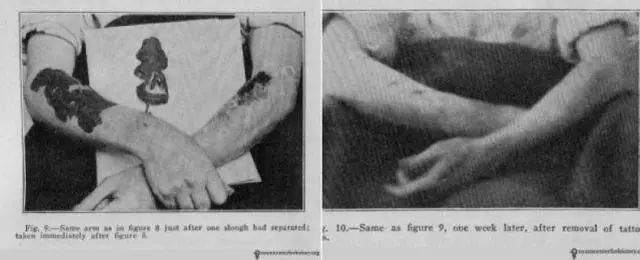 纹身后悔了怎么才能消除,半永久的纹身能去除干净吗