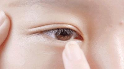 眼周脂肪粒要做什么医美,眼周围的脂肪粒适合用的护肤品