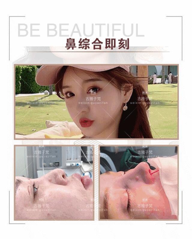 814元人气精华护理免费做！一次就焕颜新生！聚会女王就是你