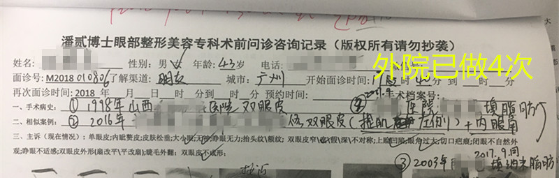 高难度修复双眼皮宽改窄恢复期,高难度双眼皮修复案例