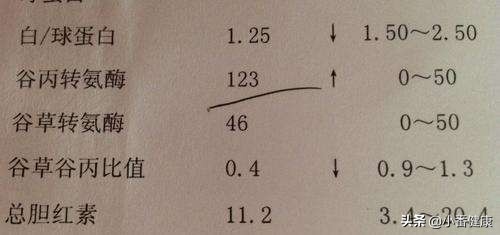 慢性乙肝出现黄疸,慢性乙肝出现黄疸升高严重吗
