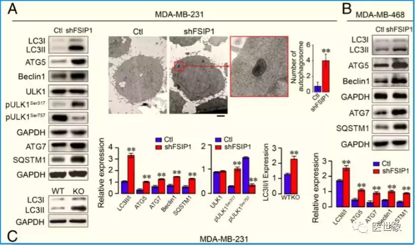 乳腺癌治疗最新研究成果,乳腺癌最新研究药