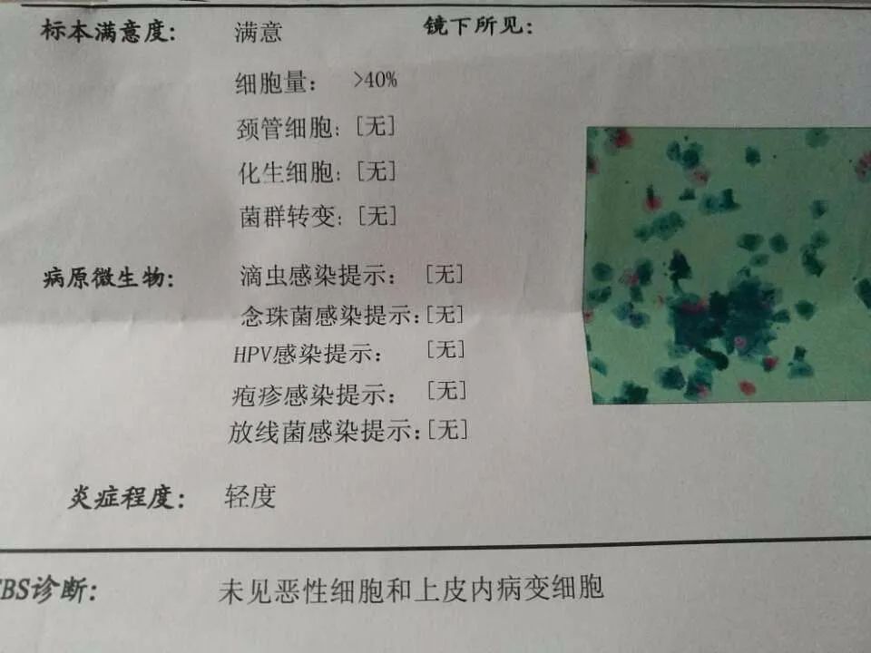 女孩多大接种hpv效果最好,女生多少岁打hpv疫苗合适