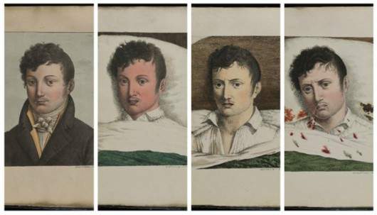 喝细菌汤，涂病人呕吐物，科学家靠“自虐”获得搞笑诺贝尔奖